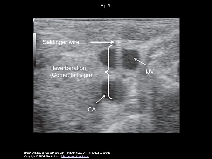 Fig 6 British Journal of Anaesthesia 2014 112794 -802 DOI: (10. 1093/bja/aet 585) Copyright