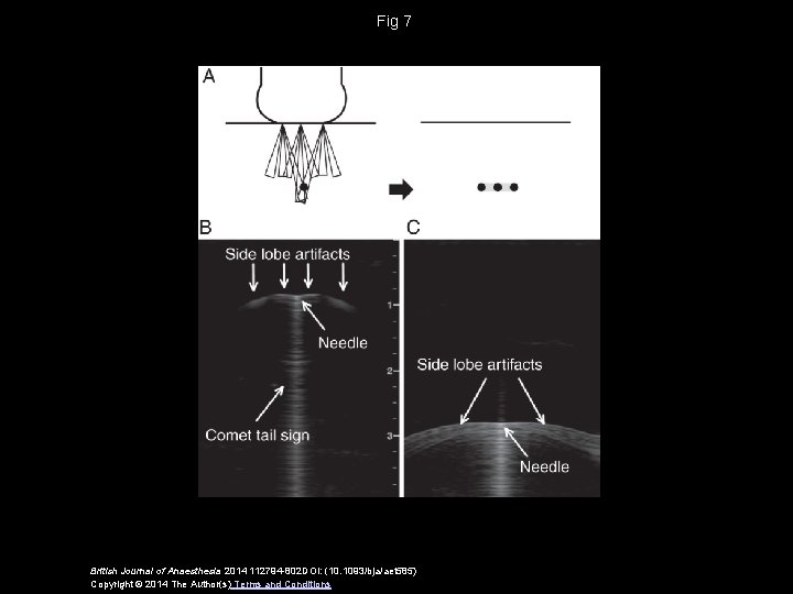 Fig 7 British Journal of Anaesthesia 2014 112794 -802 DOI: (10. 1093/bja/aet 585) Copyright