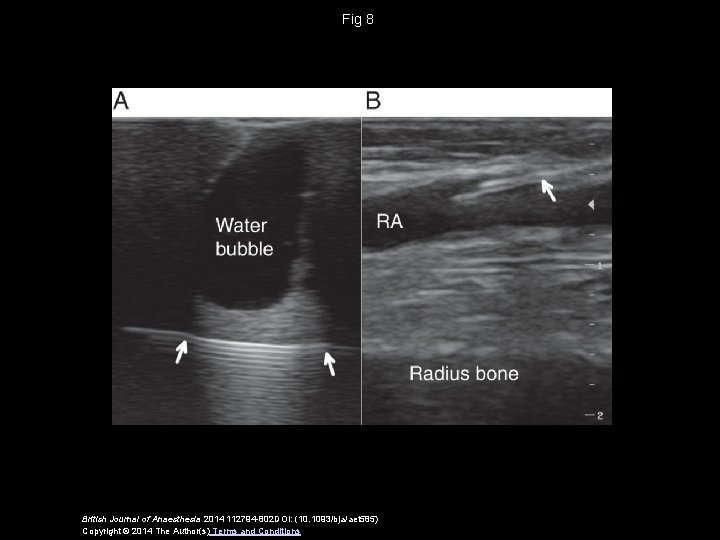 Fig 8 British Journal of Anaesthesia 2014 112794 -802 DOI: (10. 1093/bja/aet 585) Copyright