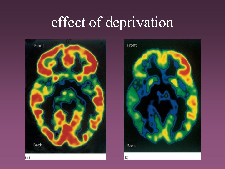 effect of deprivation 