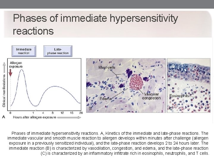 Phases of immediate hypersensitivity reactions. A, Kinetics of the immediate and late-phase reactions. The