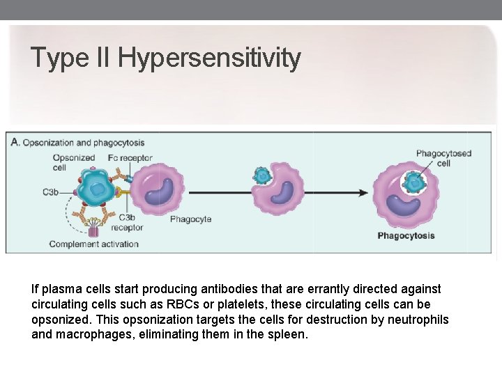 Type II Hypersensitivity If plasma cells start producing antibodies that are errantly directed against