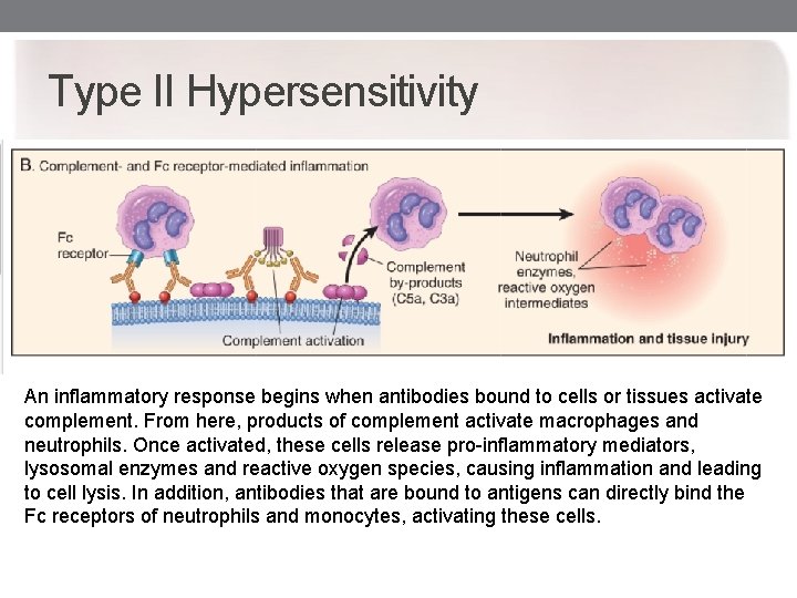 Type II Hypersensitivity An inflammatory response begins when antibodies bound to cells or tissues