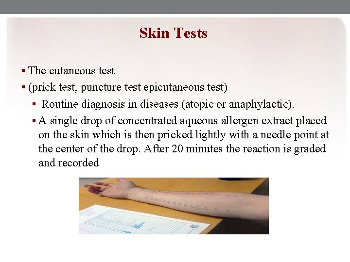 Skin Tests § The cutaneous test § (prick test, puncture test epicutaneous test) §