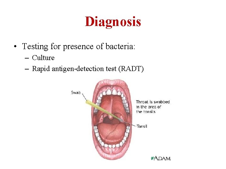 Diagnosis • Testing for presence of bacteria: – Culture – Rapid antigen-detection test (RADT)