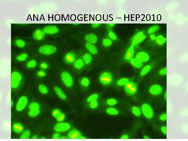 ANA HOMOGENOUS – HEP 2010 