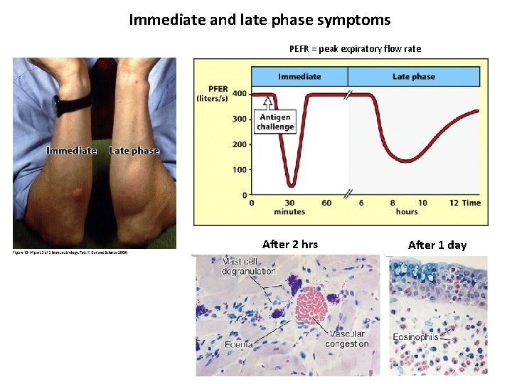 Immediate and late phase symptoms PEFR = peak expiratory flow rate After 2 hrs