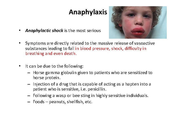 Anaphylaxis • Anaphylactic shock is the most serious • Symptoms are directly related to