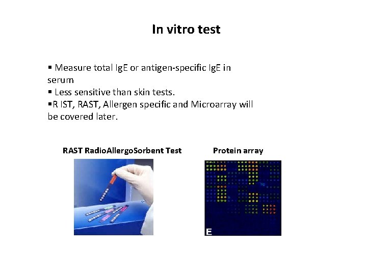 In vitro test § Measure total Ig. E or antigen-specific Ig. E in serum