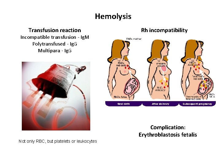 Hemolysis Transfusion reaction Incompatible transfusion - Ig. M Polytransfused - Ig. G Multipara -