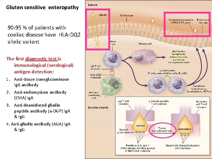 Gluten sensitive enteropathy 90 -95 % of patients with coeliac disease have HLA-DQ 2