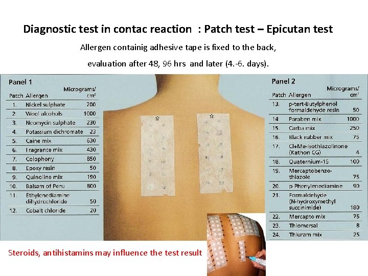 Diagnostic test in contac reaction : Patch test – Epicutan test Allergen containig adhesive