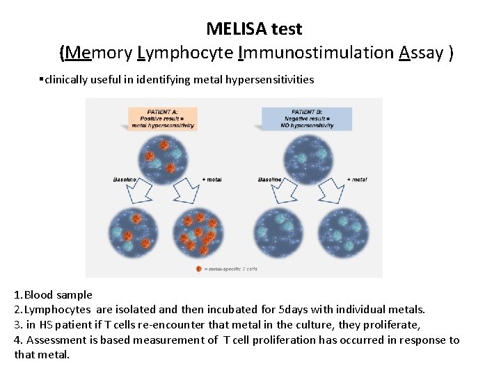 MELISA test (Memory Lymphocyte Immunostimulation Assay ) §clinically useful in identifying metal hypersensitivities 1.