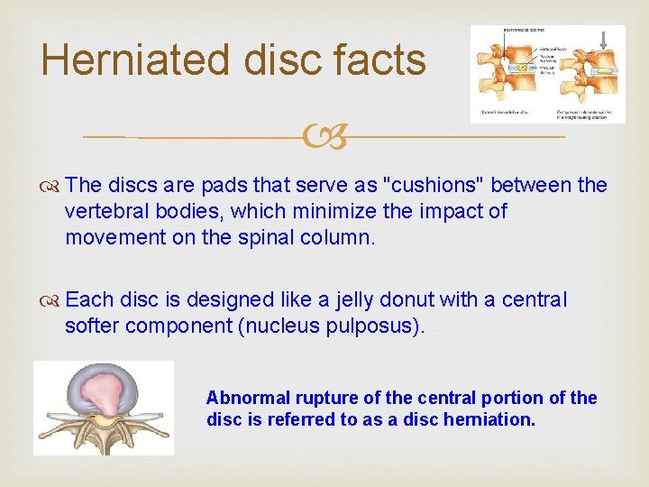 Herniated disc facts The discs are pads that serve as "cushions" between the vertebral