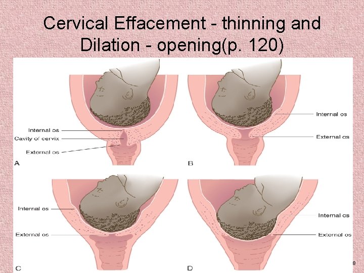 Cervical Effacement - thinning and Dilation - opening(p. 120) Elsevier items and derived items