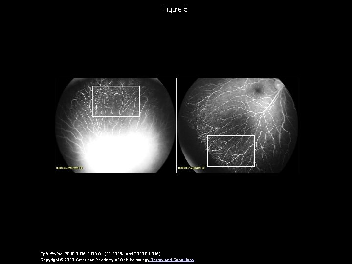 Figure 5 Oph Retina 2019 3436 -443 DOI: (10. 1016/j. oret. 2019. 016) Copyright