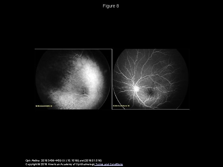 Figure 8 Oph Retina 2019 3436 -443 DOI: (10. 1016/j. oret. 2019. 016) Copyright