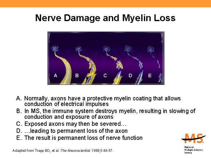 Nerve Damage and Myelin Loss A B C D E A. Normally, axons have