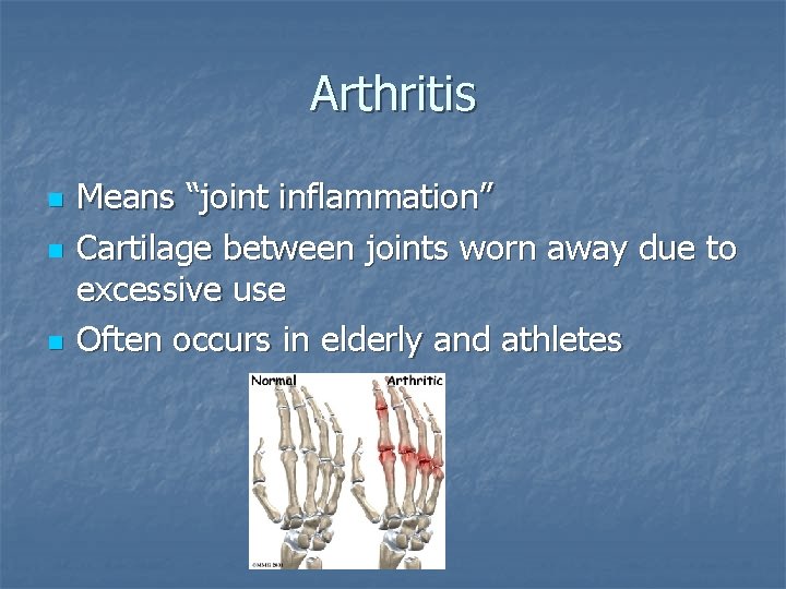 Arthritis n n n Means “joint inflammation” Cartilage between joints worn away due to