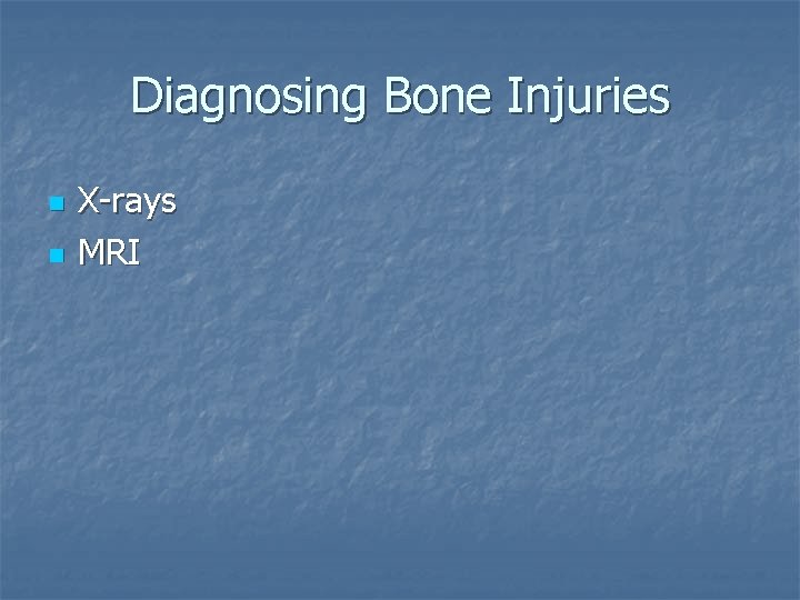 Diagnosing Bone Injuries n n X-rays MRI 