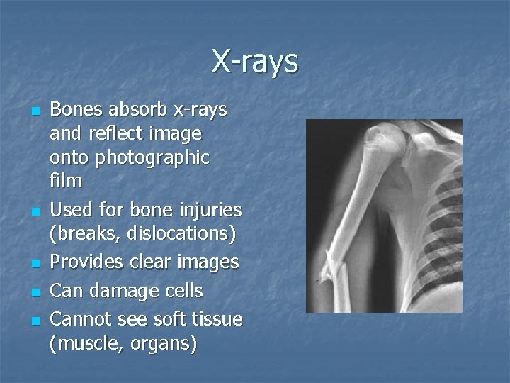 X-rays n n n Bones absorb x-rays and reflect image onto photographic film Used