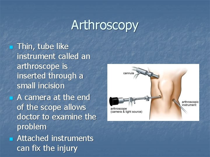 Arthroscopy n n n Thin, tube like instrument called an arthroscope is inserted through