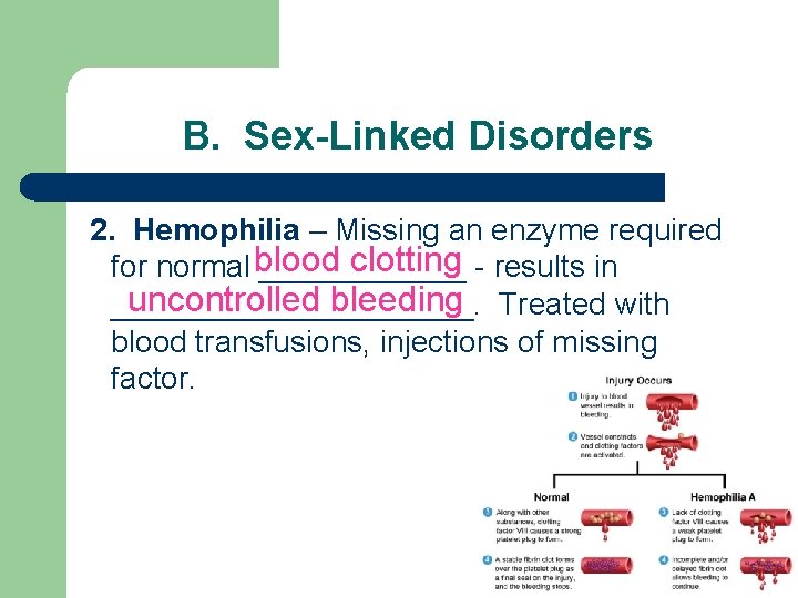 B. Sex-Linked Disorders 2. Hemophilia – Missing an enzyme required blood clotting for normal