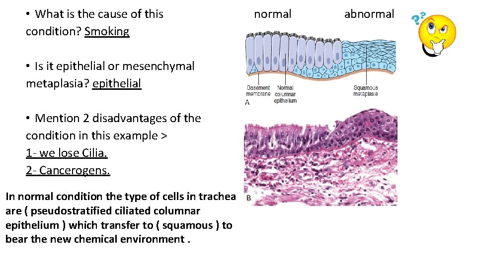  • What is the cause of this condition? Smoking • Is it epithelial