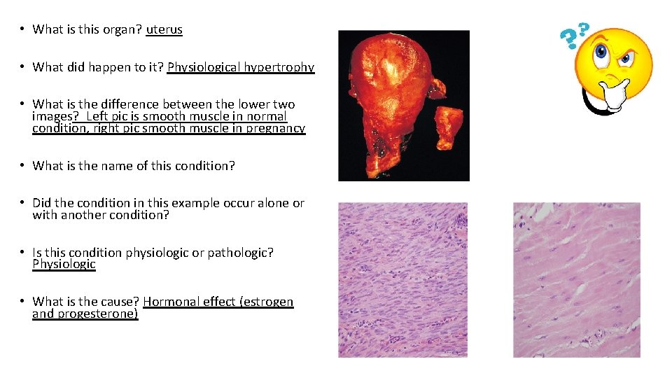  • What is this organ? uterus • What did happen to it? Physiological