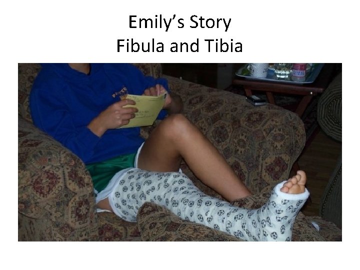 Emily’s Story Fibula and Tibia 