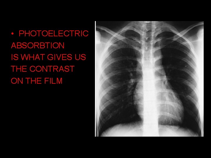  • PHOTOELECTRIC ABSORBTION IS WHAT GIVES US THE CONTRAST ON THE FILM 14