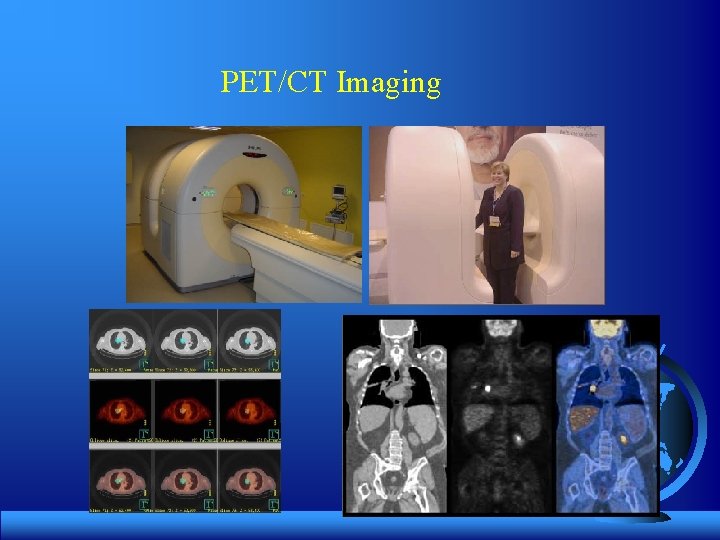 PET/CT Imaging 