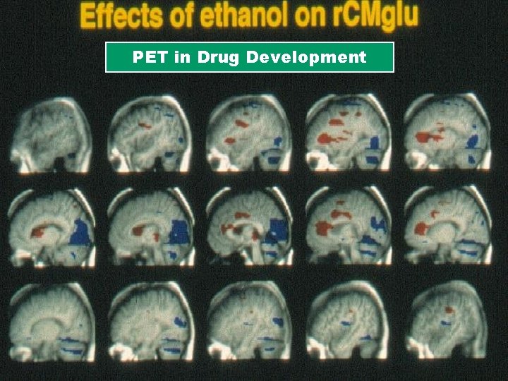 PET in Drug Development 