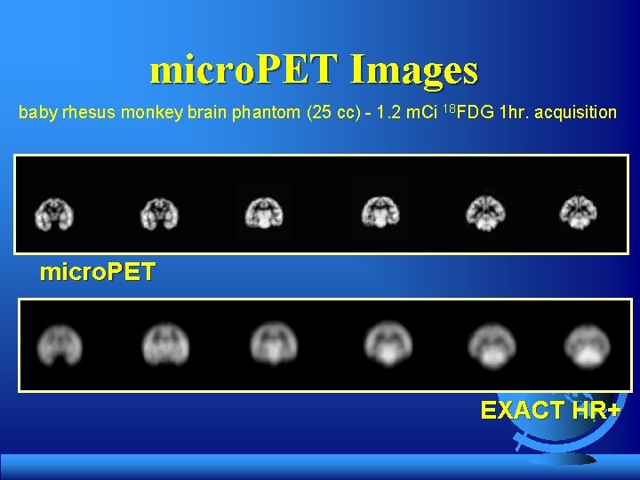 micro. PET Images baby rhesus monkey brain phantom (25 cc) - 1. 2 m.