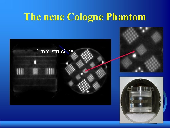 The neue Cologne Phantom 3 mm structure 2 mm structure 