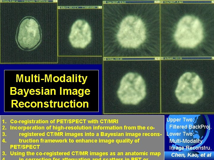 Multi-Modality Bayesian Image Reconstruction Upper Two: 1. Co-registration of PET/SPECT with CT/MRI Filtered Back.