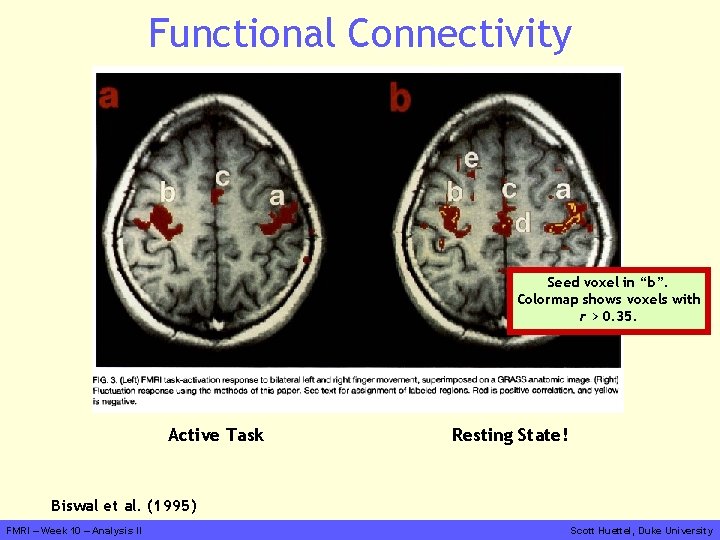 Functional Connectivity Seed voxel in “b”. Colormap shows voxels with r > 0. 35.