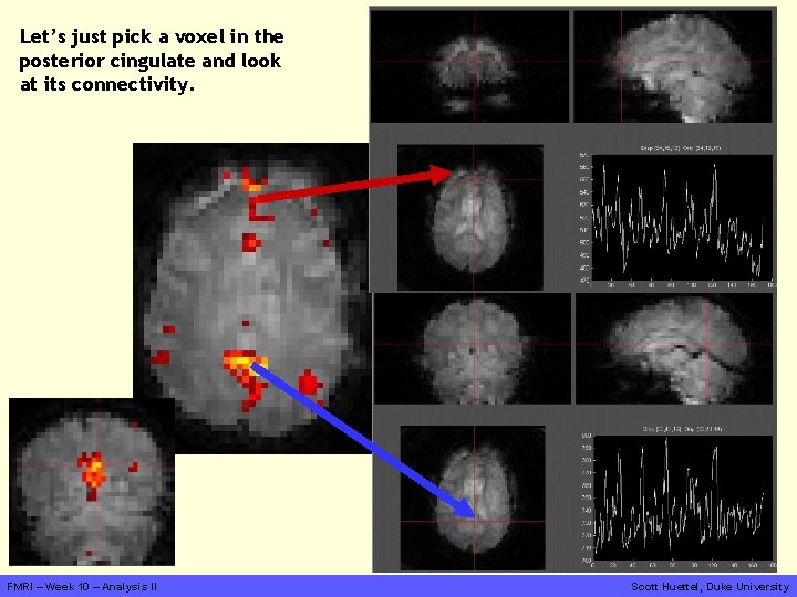 Let’s just pick a voxel in the posterior cingulate and look at its connectivity.