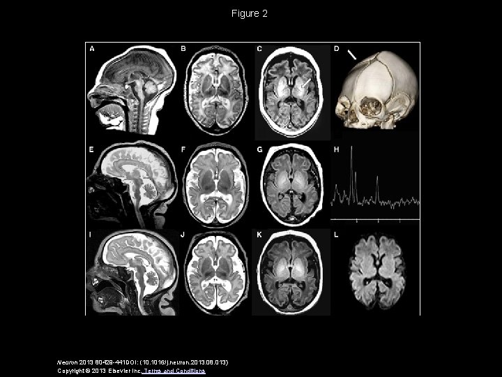 Figure 2 Neuron 2013 80429 -441 DOI: (10. 1016/j. neuron. 2013. 08. 013) Copyright