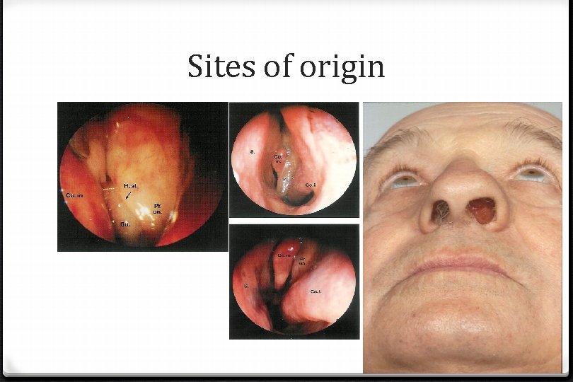 Sites of origin 