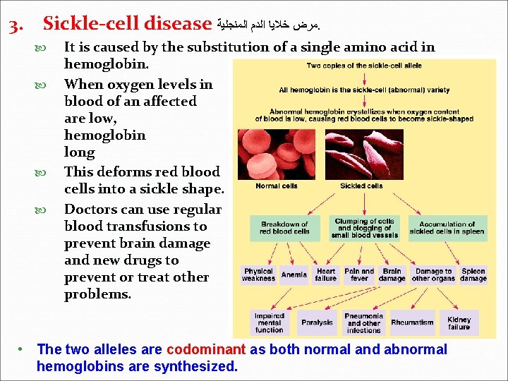 3. Sickle-cell disease ﻣﺮﺽ ﺧﻼﻳﺎ ﺍﻟﺪﻡ ﺍﻟﻤﻨﺠﻠﻴﺔ. It is caused by the substitution of 3. Sickle-cell disease ﻣﺮﺽ ﺧﻼﻳﺎ ﺍﻟﺪﻡ ﺍﻟﻤﻨﺠﻠﻴﺔ. It is caused by the substitution of