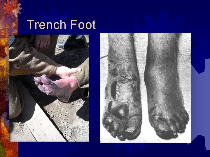 Trench Foot 