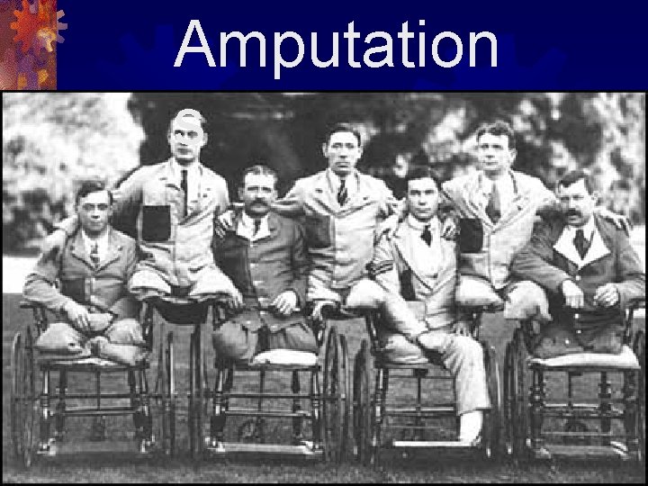 Amputation s 