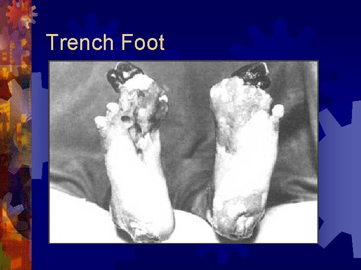 Trench Foot 