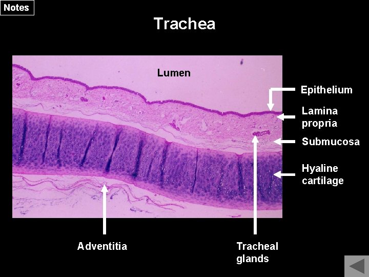 Notes Trachea Lumen Epithelium Lamina propria Submucosa Hyaline cartilage Adventitia Tracheal glands 