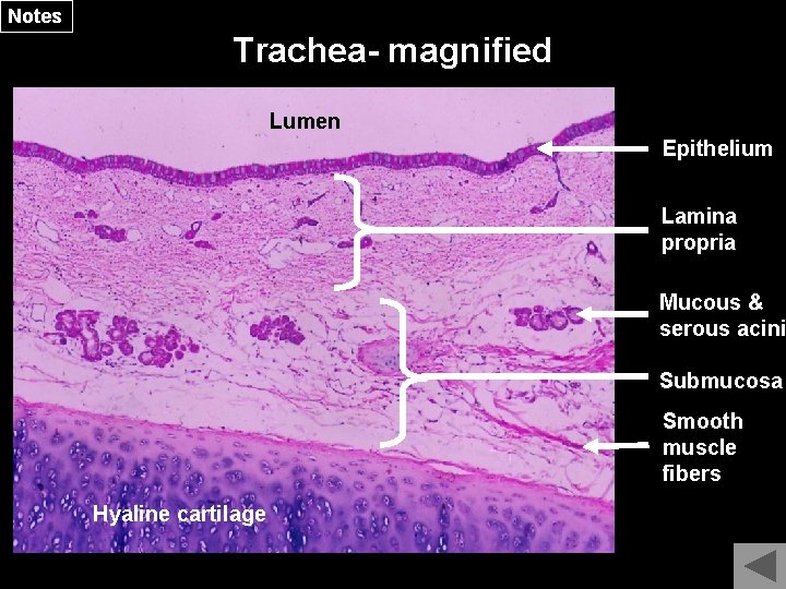 Notes Trachea- magnified Lumen Epithelium Lamina propria Mucous & serous acini Submucosa Smooth muscle