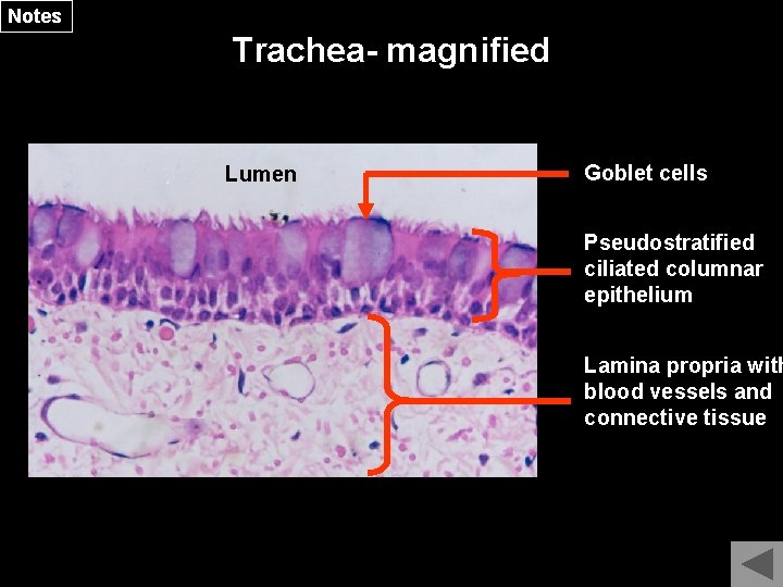 Notes Trachea- magnified Lumen Goblet cells Pseudostratified ciliated columnar epithelium Lamina propria with blood