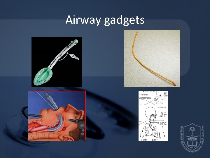 Airway gadgets Airway gadgets