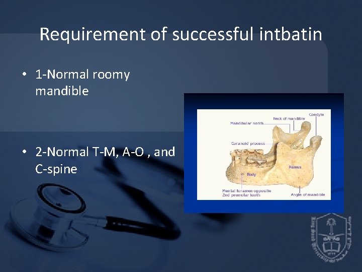 Requirement of successful intbatin • 1 -Normal roomy mandible • 2 -Normal T-M, A-O Requirement of successful intbatin • 1 -Normal roomy mandible • 2 -Normal T-M, A-O