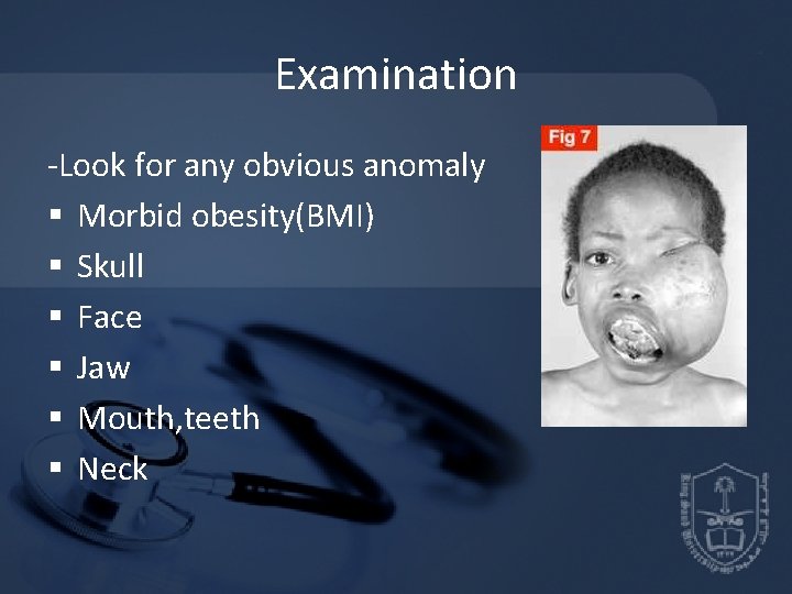 Examination -Look for any obvious anomaly § Morbid obesity(BMI) § Skull § Face § Examination -Look for any obvious anomaly § Morbid obesity(BMI) § Skull § Face §